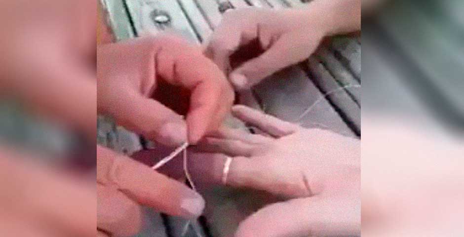 Cómo sacarte un anillo encajado en un dedo 15